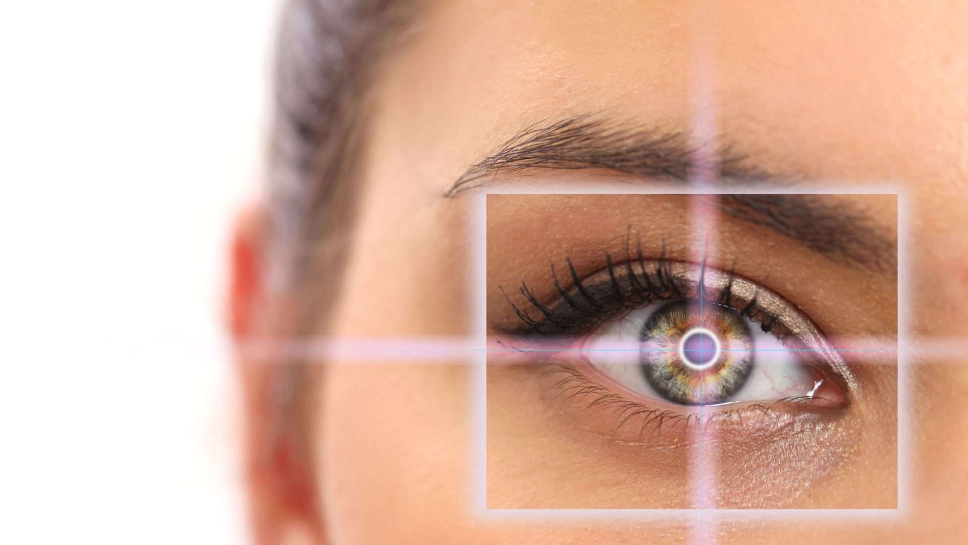 LASIK frequently asked questions